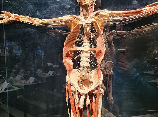 Trip to Body Worlds exhibition