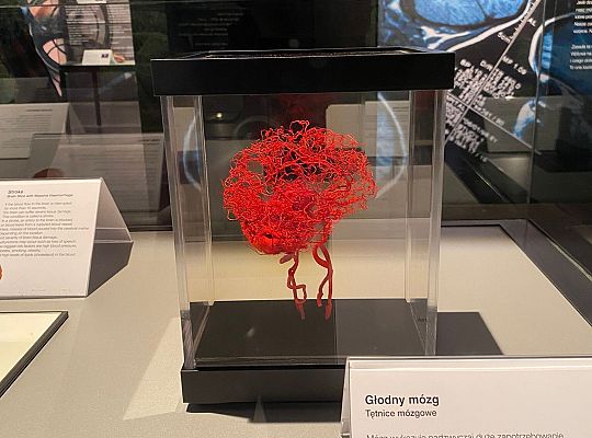 Trip to Body Worlds exhibition