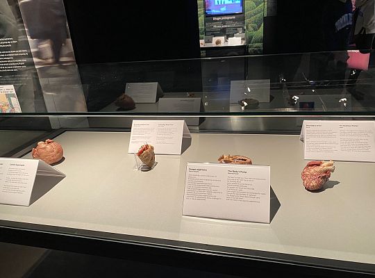 Trip to Body Worlds exhibition