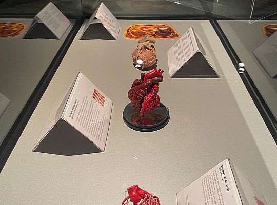 Trip to Body Worlds exhibition