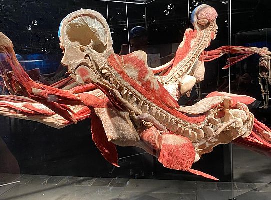 Trip to Body Worlds exhibition